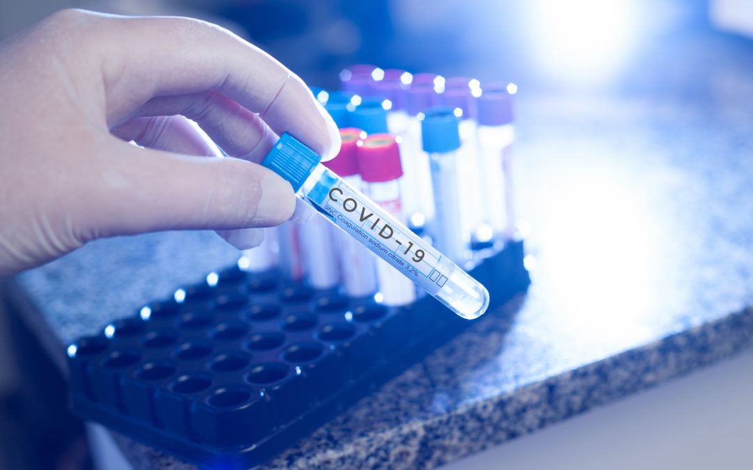 TESTE IGG VERIFICAM A IMUNIDADE